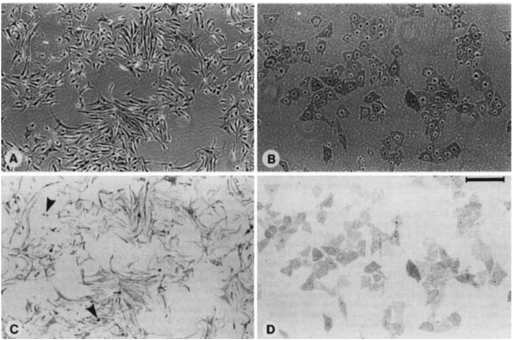 Melan-a cells adopted from PMID 3102392 Fig.1